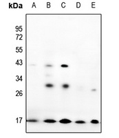 Prothymosin alpha Antibody
