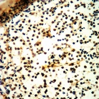Prothymosin alpha Antibody