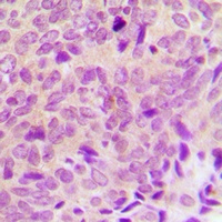 Anti-PTP1B Antibody