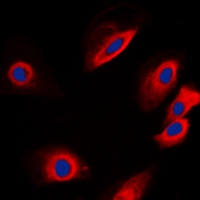 Anti-PTP1B Antibody