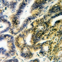 Anti-PTPD1 Antibody