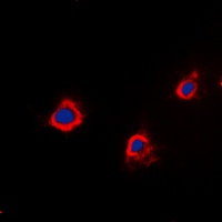Anti-PTTG1IP Antibody