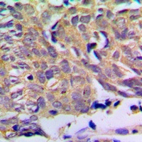 Anti-PXMP2 Antibody