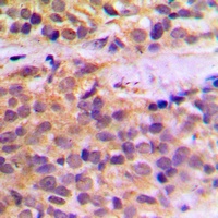 Anti-RAB11FIP1 Antibody