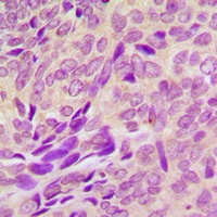 Anti-RAB41 Antibody