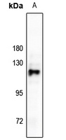 RB1 Antibody