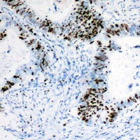 RB1 Antibody