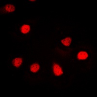 Anti-hnRNP G Antibody