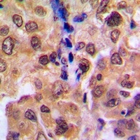 RAD52B Antibody