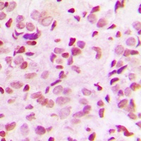 Anti-NF-kappaB p65 (Phospho-T435) Antibody