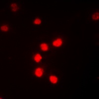 Anti-NF-kappaB p65 (Phospho-T435) Antibody