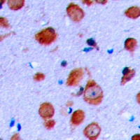 Anti-RET Antibody