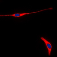 Anti-RET Antibody