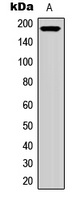 RET Rabbit Polyclonal Antibody