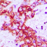 Anti-RET Antibody