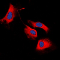 Anti-RET Antibody