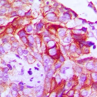 Anti-RET (Phospho-Y1062) Antibody