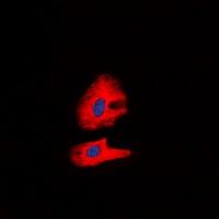 Anti-RET (Phospho-Y1062) Antibody