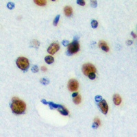 Anti-RFWD3 Antibody