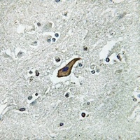 Anti-ROBO2 Antibody