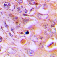 Anti-RPL18 Antibody