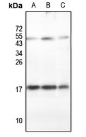 RPLP2 Antibody