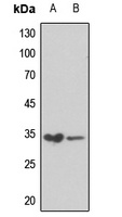 RPS6 (Phospho-S240) Antibody