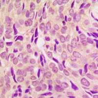 Anti-RPS6 (Phospho-S240) Antibody