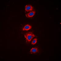 RPS6 (phospho-S240) antibody