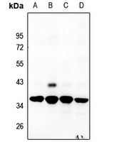 RPS6 Rabbit Polyclonal Antibody