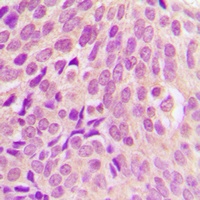 RPS6 antibody