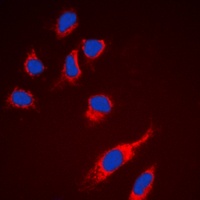 Anti-RPS6 Antibody