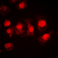MSK1 antibody