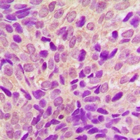 RSK4 Antibody