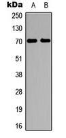 S6K1 Rabbit Polyclonal Antibody
