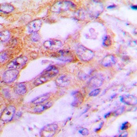 S6K1 Rabbit Polyclonal Antibody