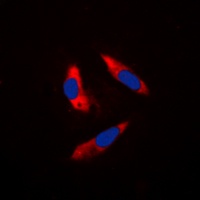 S6K1 Rabbit Polyclonal Antibody