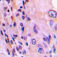 RTKN Antibody