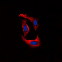 Anti-Ryanodine Receptor 2 (Phospho-S2808) Antibody