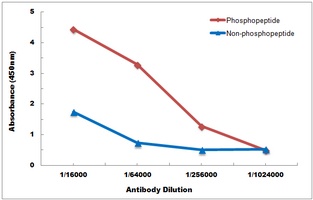 Anti-Ryanodine Receptor 2 (Phospho-S2808) Antibody