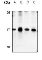 S100-A7 Rabbit Polyclonal Antibody