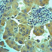 S100-A7 Rabbit Polyclonal Antibody