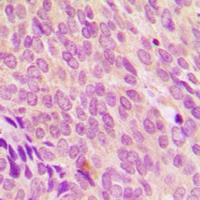 Anti-SDCCAG8 Antibody