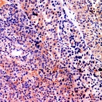 Anti-Serpin B3/4 Antibody