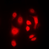 Anti-SGK1/2 (Phospho-T256/253) Antibody