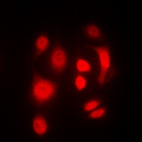 SGK1/2 (phospho-T256/253) antibody