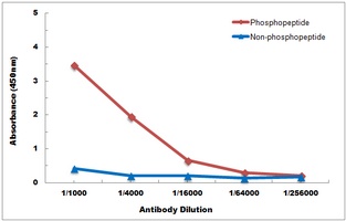 Anti-SGK1/2 (Phospho-T256/253) Antibody