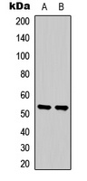 SGK1 Rabbit Polyclonal Antibody