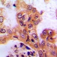Anti-SGK1 Antibody