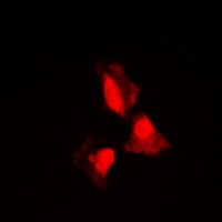 Anti-SGK1 Antibody